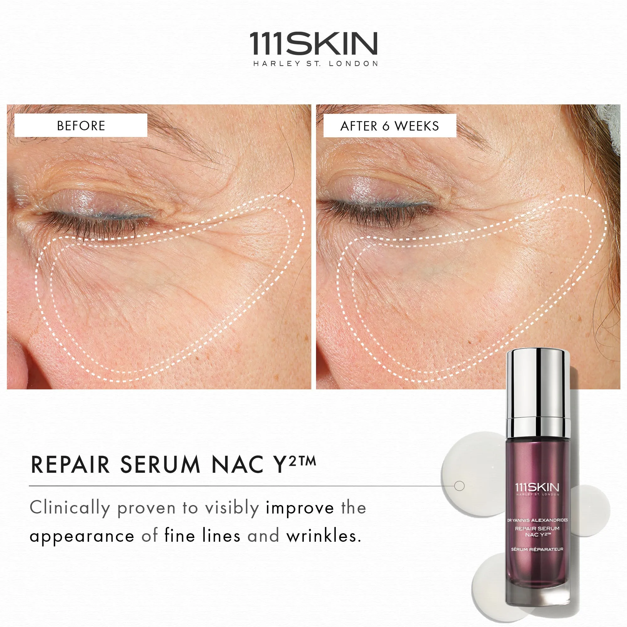 Repair Serum Nacy2